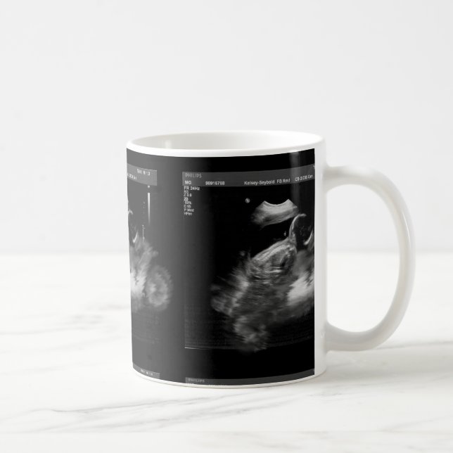 Motorradsonogram-Tasse Tasse (Rechts)