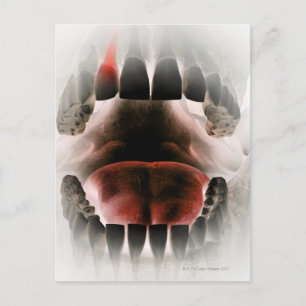 Mouth Postkarte