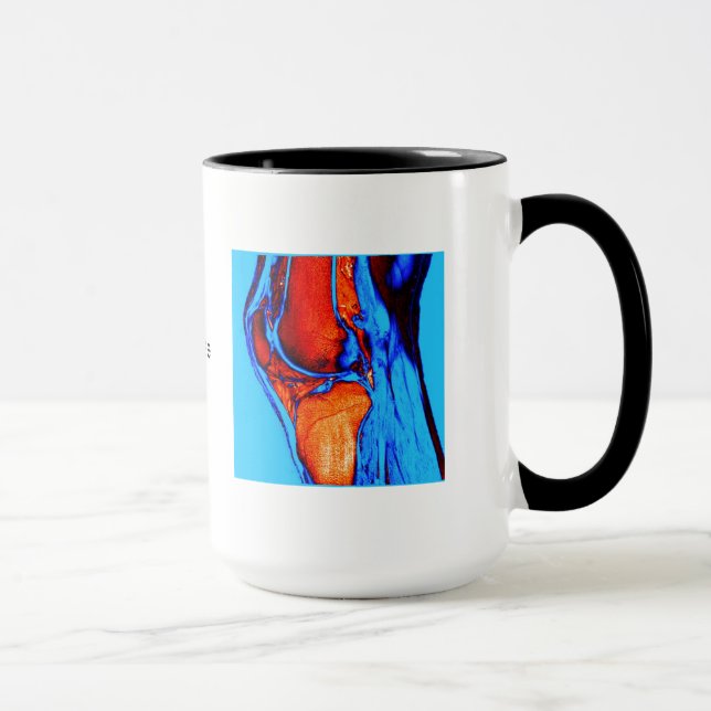 MRI des Knies Tasse (Rechts)