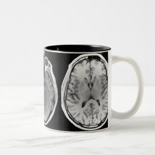 MRI Gehirn-Bild-Tasse Zweifarbige Tasse