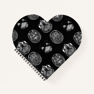 MRT des Gehirns Notizbuch