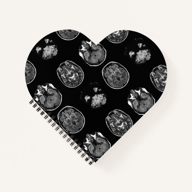 MRT des Gehirns Notizbuch (Vorderseite)