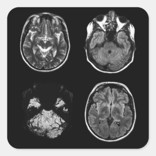MRT des Gehirns Quadratischer Aufkleber