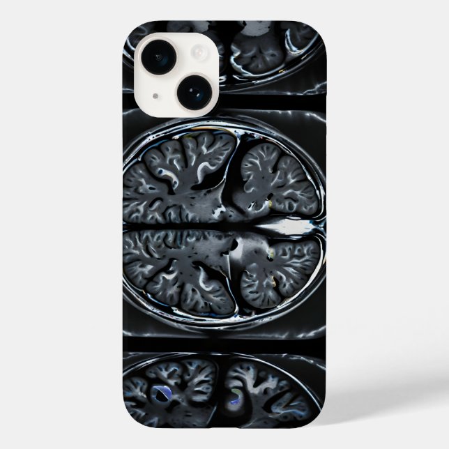 MRT-Gehirnuntersuchung Case-Mate iPhone Hülle (Rückseite)