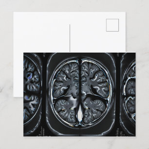 MRT-Gehirnuntersuchung Postkarte