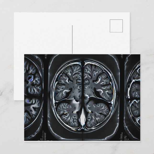 MRT-Gehirnuntersuchung Postkarte (Vorne/Hinten)