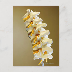 Nahes Aufsetzen eines medizinischen Wirbelkörpers Postkarte