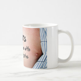 Narben sind Tätowierungen mit besseren Geschichten Tasse