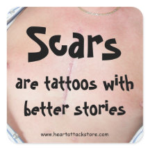 Narben sind Tattoos mit einer besseren Geschichte