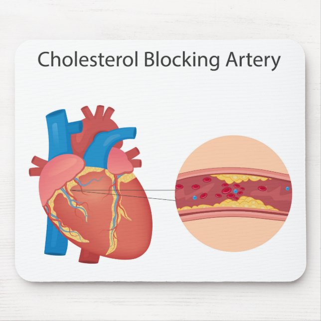 Narkose Blutgefäße Mousepad (Vorne)