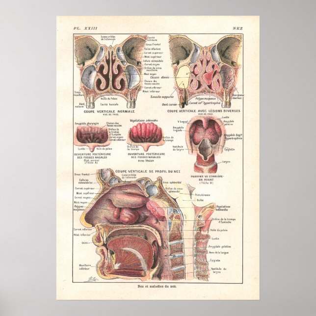 Nase & Sinuses Anatomy Poster auf Französisch (Vorne)
