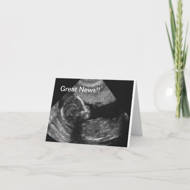 Neuer Baby-Ultraschall Ankündigung (Vorderseite)