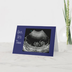 Neues Baby Anouncement Ankündigung