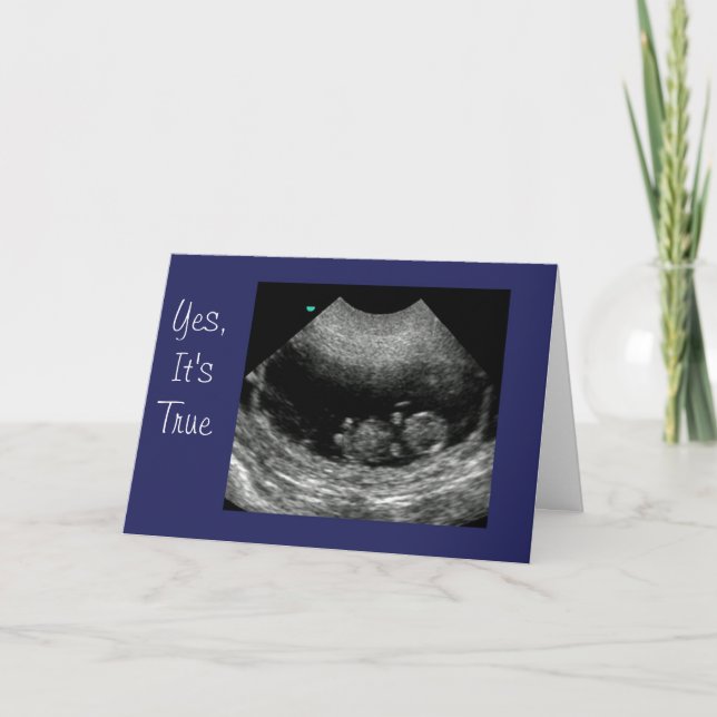 Neues Baby Anouncement Ankündigung (Vorderseite)