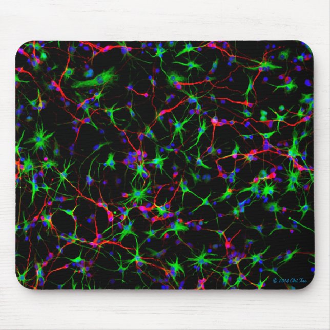 NeurologieMausunterlage Mousepad (Vorne)