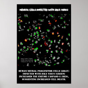 Neuronale Zellen infiziert mit Zika Poster von Ros