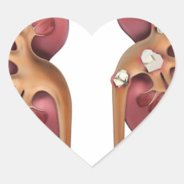 Nieren Herz-Aufkleber