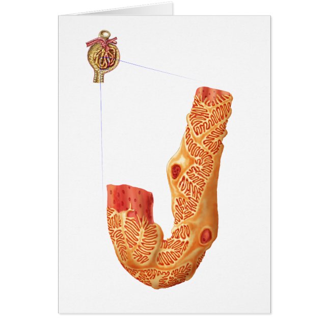 Nierenkorpuskel und Filtrationsmembran (Vorne)