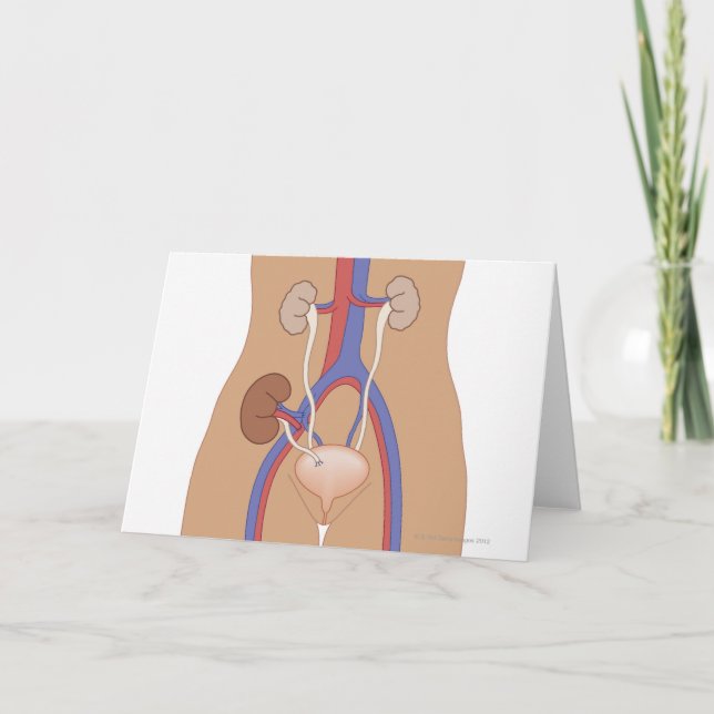 Nierentransplantation Karte (Vorderseite)