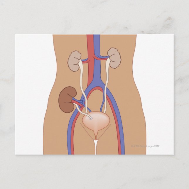 Nierentransplantation Postkarte (Vorderseite)