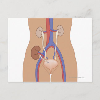 Nierentransplantation Postkarte