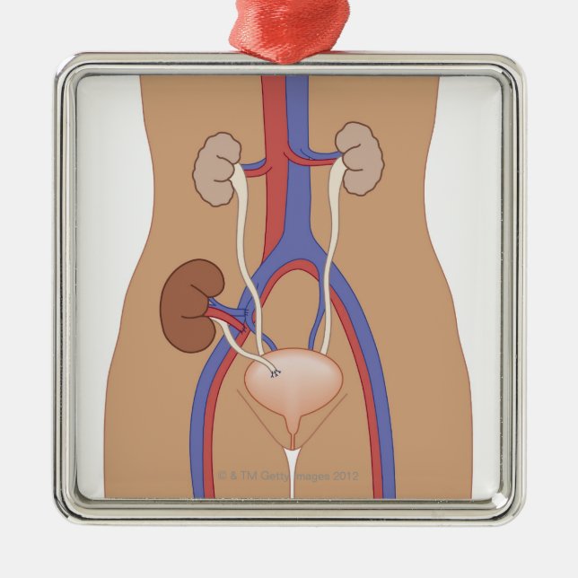 Nierentransplantation Silbernes Ornament (Vorne)