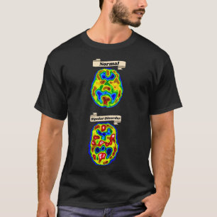 Normal vs Bipolar Gehirnscan T-Shirt