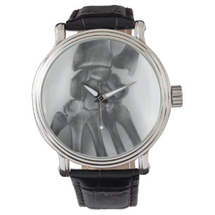 Normales Handgelenk, Röntgenaufnahme Armbanduhr