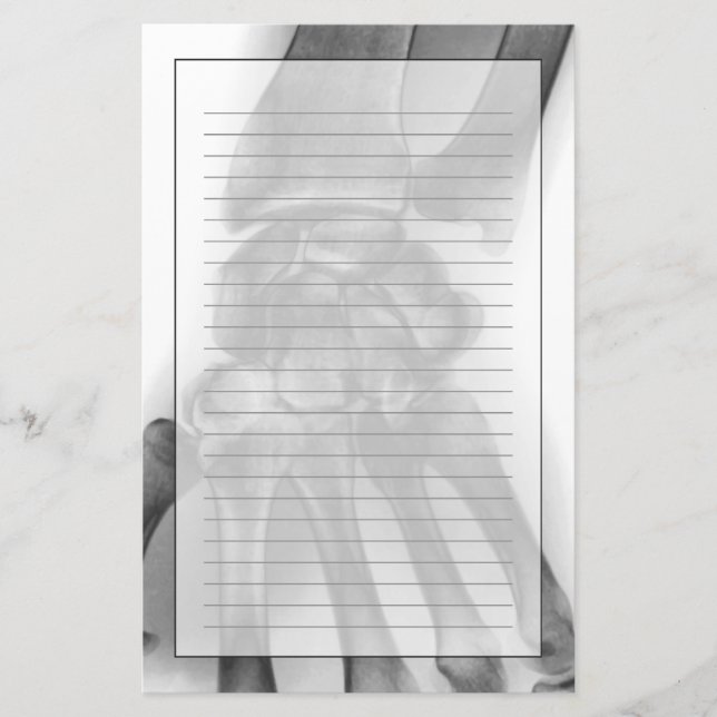 Normales Handgelenk, Röntgenstrahl Briefpapier (Vorderseite)