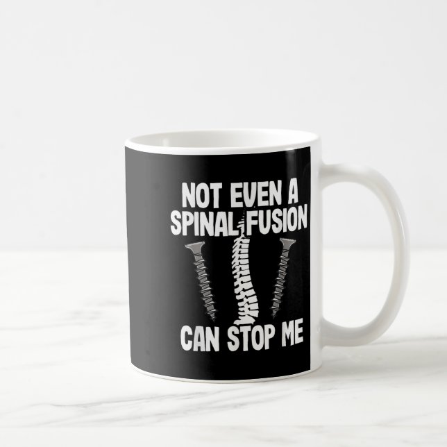 Not Even A Snal Fusion Can Stop Me Back Surgery Re Kaffeetasse (Rechts)