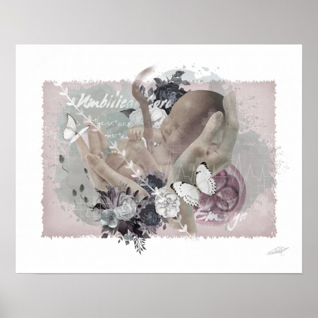 Obgyn Poster (Vorne)