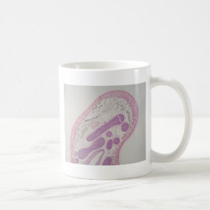 Parasitärer Fadenwurmwurm (Ascarid-SP.) Kaffeetasse