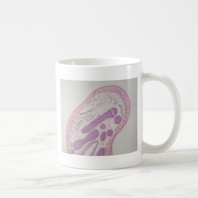 Parasitärer Fadenwurmwurm (Ascarid-SP.) Kaffeetasse (Rechts)