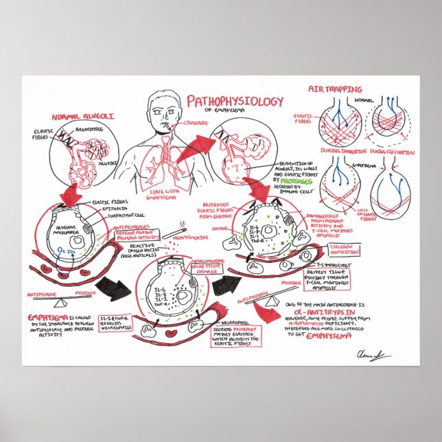 Pathophysiologie des Emphysemas Poster (Vorne)