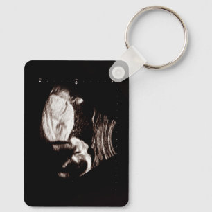 Personalisiert Baby Ultrasound Schlüsselanhänger