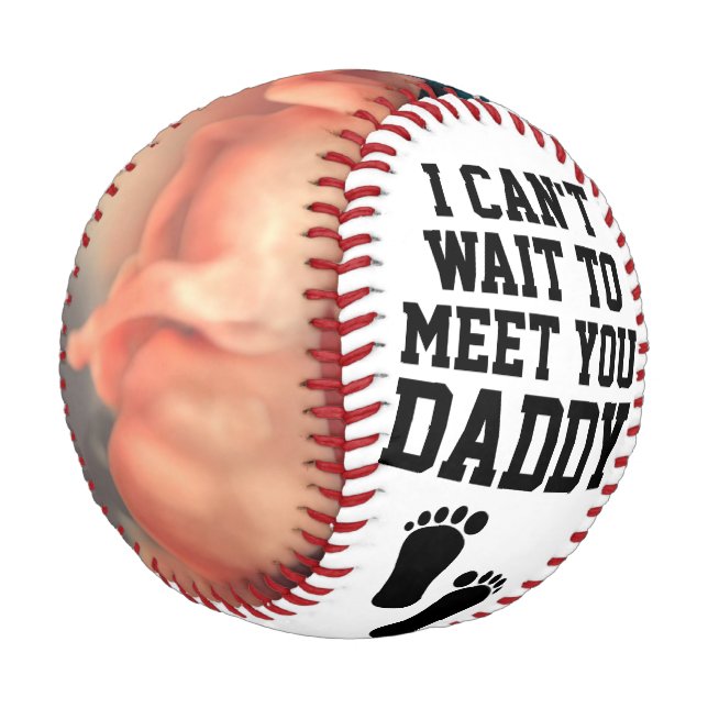 Personalisiert Sonogram Ultrasound New Daddy Baby Baseball (Schrägansicht)
