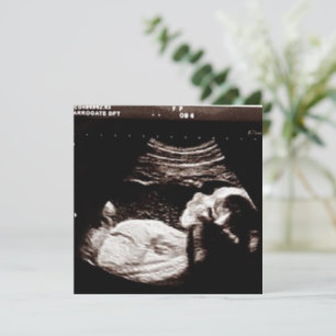 Personalisierte Ultraschallbild Babydusche Einladung