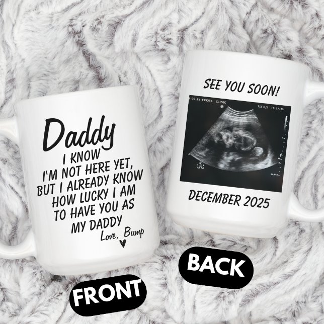 Personalized Sonogram Photo, Ultrasound Photo Baby Kaffeetasse (Von Creator hochgeladen)