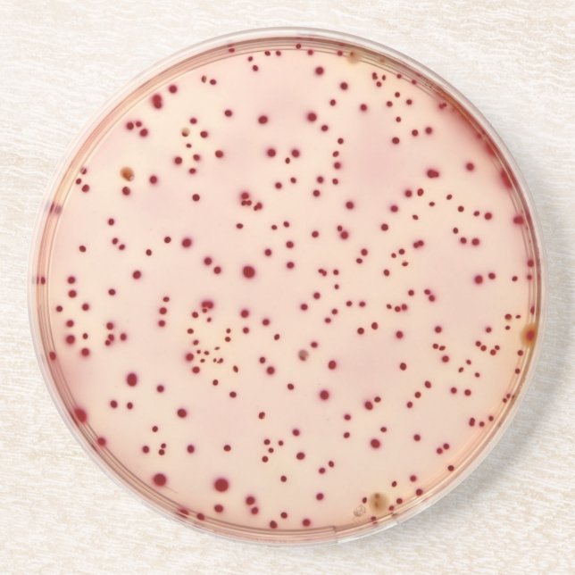 Petrischalen-Untersetzer Getränkeuntersetzer (Vorne)