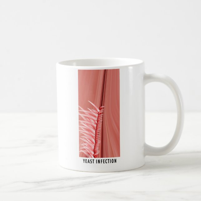 Pilzinfektion Tasse (Rechts)