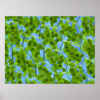 Plagiomnium Affine Pflanze Zellen mit Chloroplaste