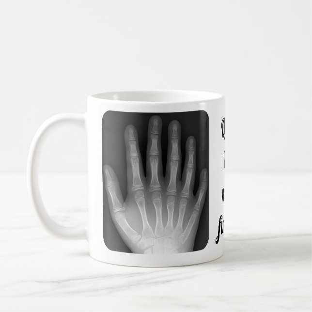 Polydactyl Handröntgenstrahl Kaffeetasse (Links)