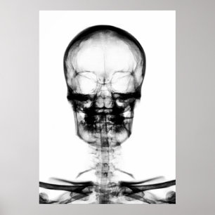 POSTER/DRUCKER X-RAY VISION SKELETON SKULL - B&W POSTER