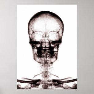 POSTER/DRUCKER X-RAY VISION SKELETON SKULL ORIG/NE POSTER
