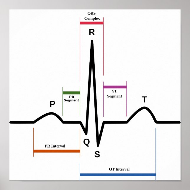 Poster Sinus Rhythm EKG-Diagramm (Vorne)