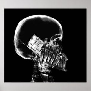 POSTER - X-RAY SKELETON AUF TELEFON BLK GRAY