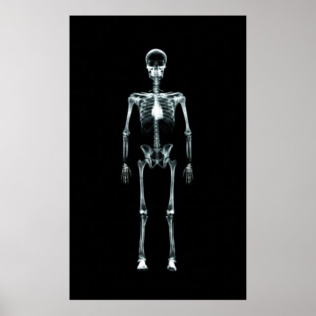 Poster - X-Ray Vision Single Skeletton Original (Vorne)