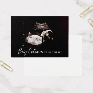 Pregnancy Anuncement Sonogram Mini Card