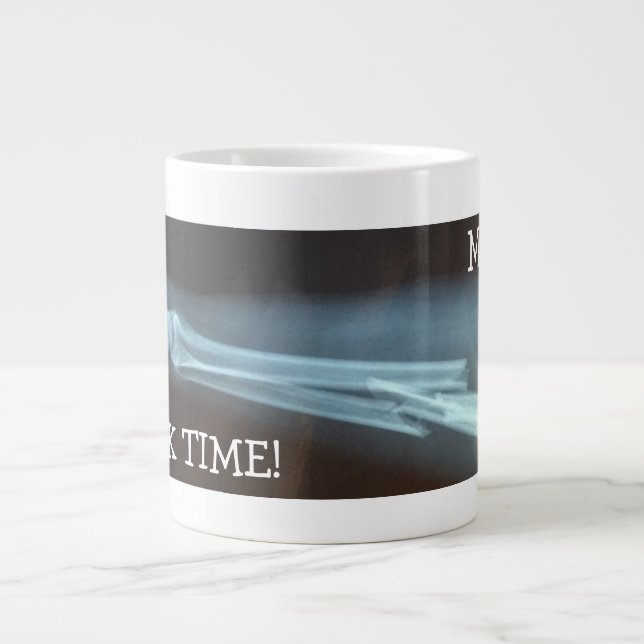 Radius und Ulna Xray "Break Time" Jumbo-Tasse (Vorderseite)