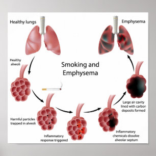 Rauchen und Emphysema Poster